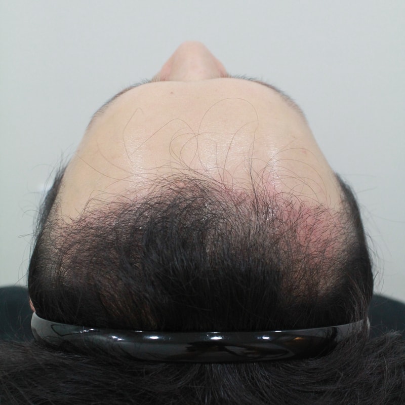 44.jpg