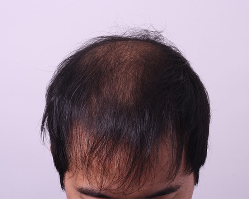 수술전1.jpg
