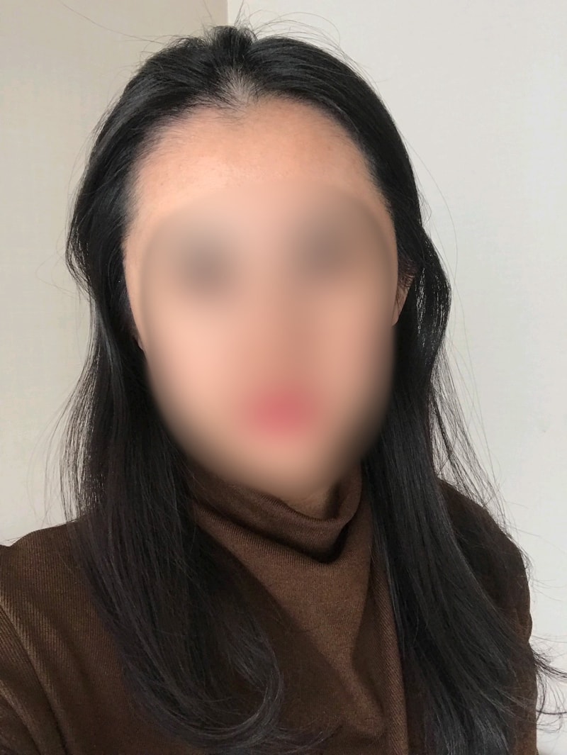ダナ整形外科116日目