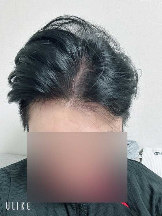 앞정면.jpg