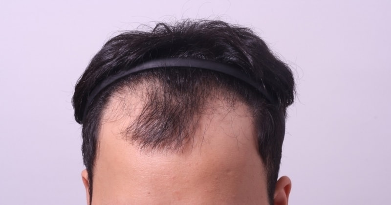 수술전.jpg
