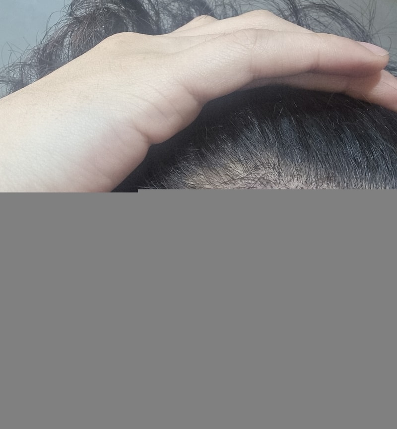 지문샴푸후2.png