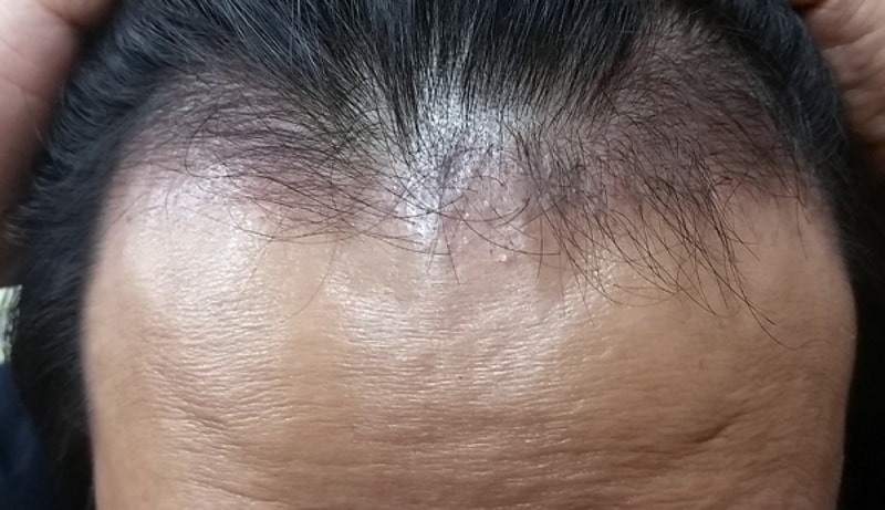 딱 3달이여  이젠 한숨 돌리겠네요
