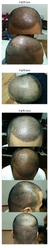 편집15일.jpg