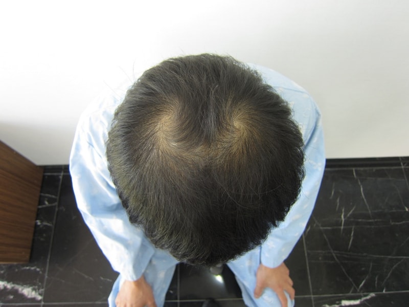 시술전1.JPG