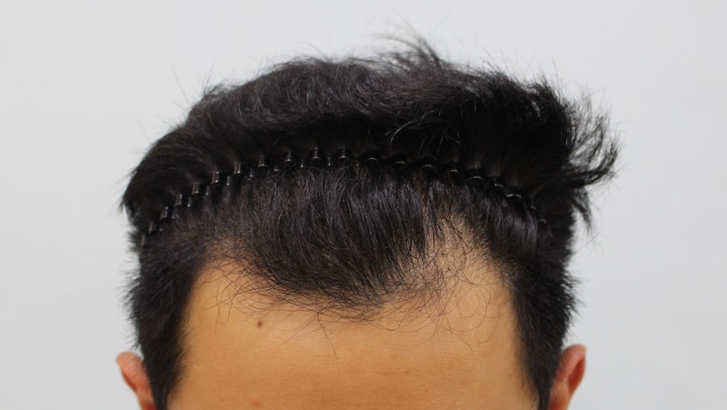 수술전.jpg