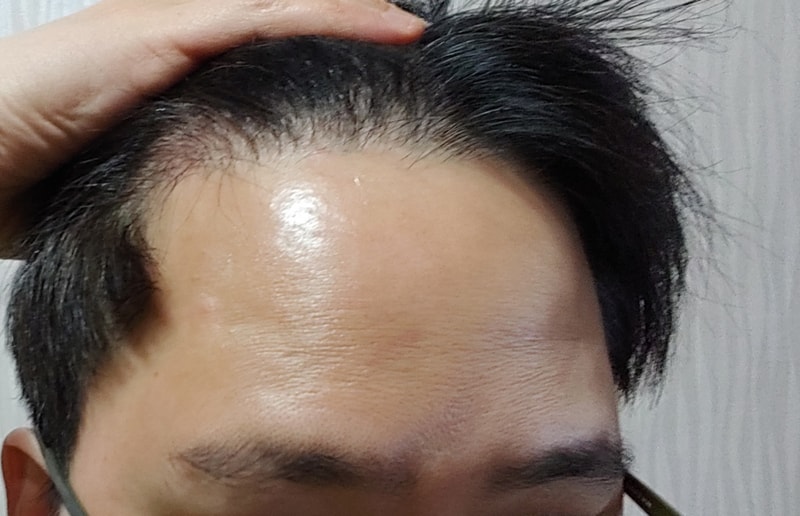 4개월차 입니다.