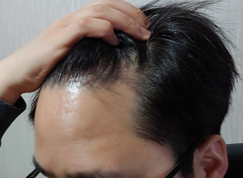 4개월 오른쪽.png