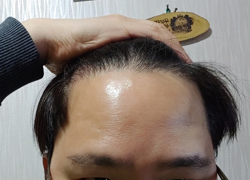 4개월 정면.png