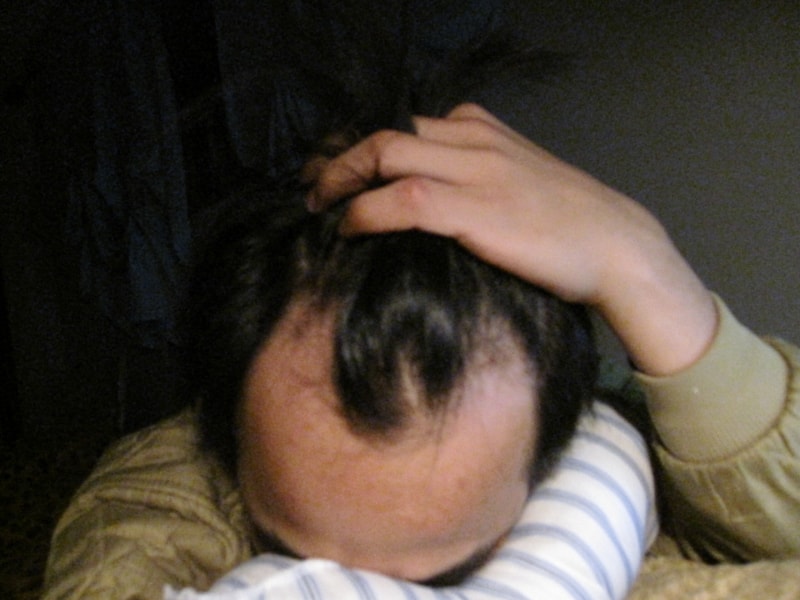 수술전 1.jpg
