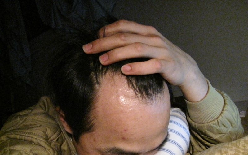 수술전 2.jpg