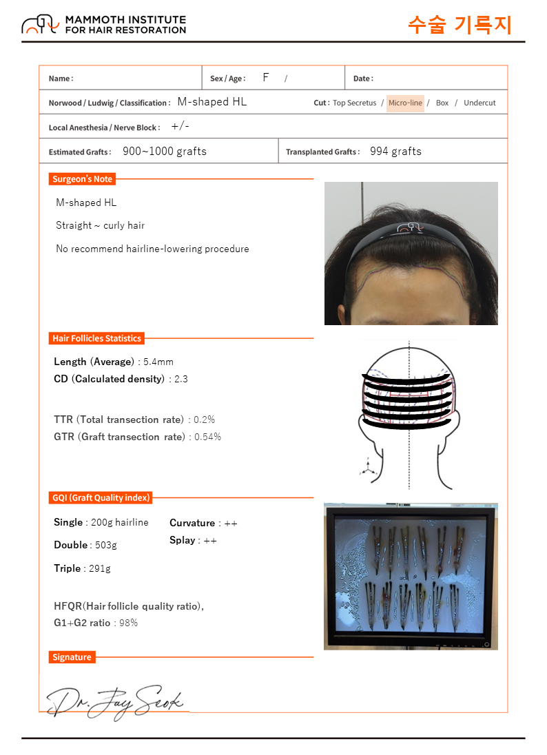 Female hair transplant reviews that were all so much better than mammoth rumors.