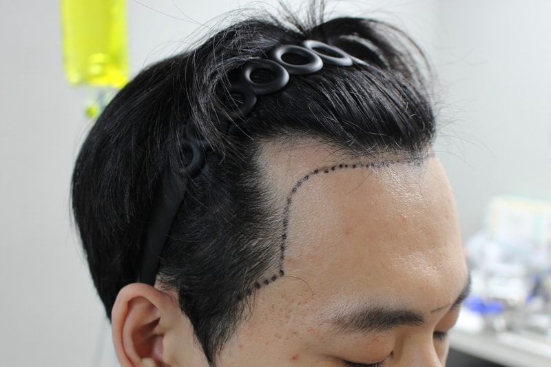 KakaoTalk_20250313_155631424_01.jpg