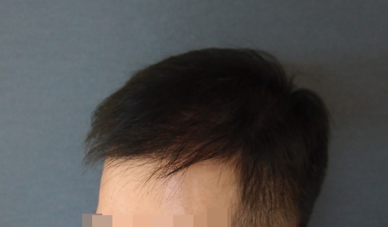 수술후3.jpg