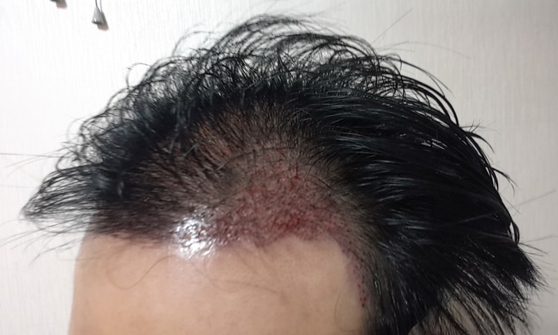 KakaoTalk_20170312_122153500.jpg