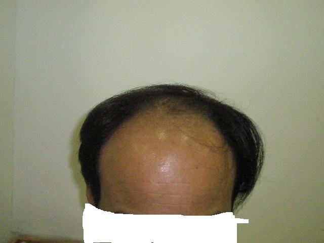 수술전1.JPG