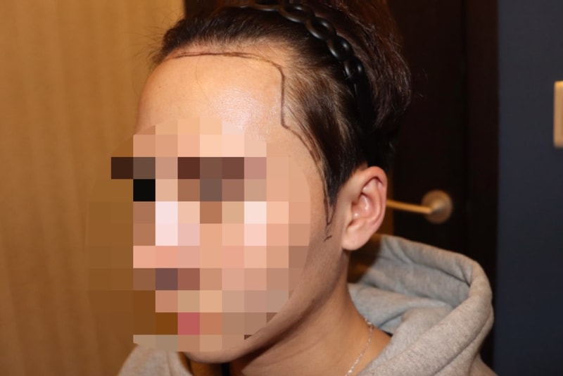 초진_측면.jpg