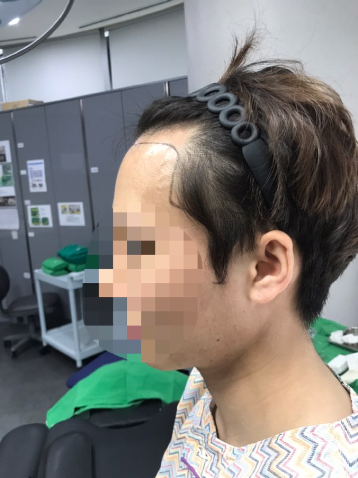 수술_직전.jpg