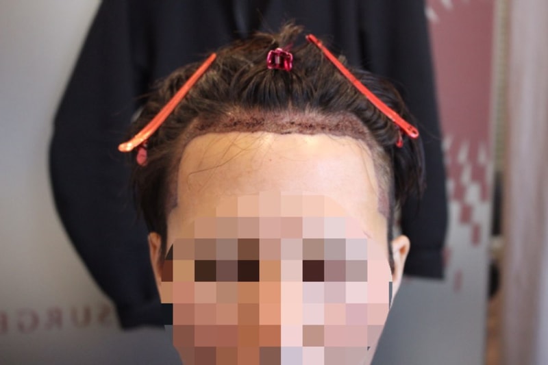 D+1 샴푸후_정면.jpg