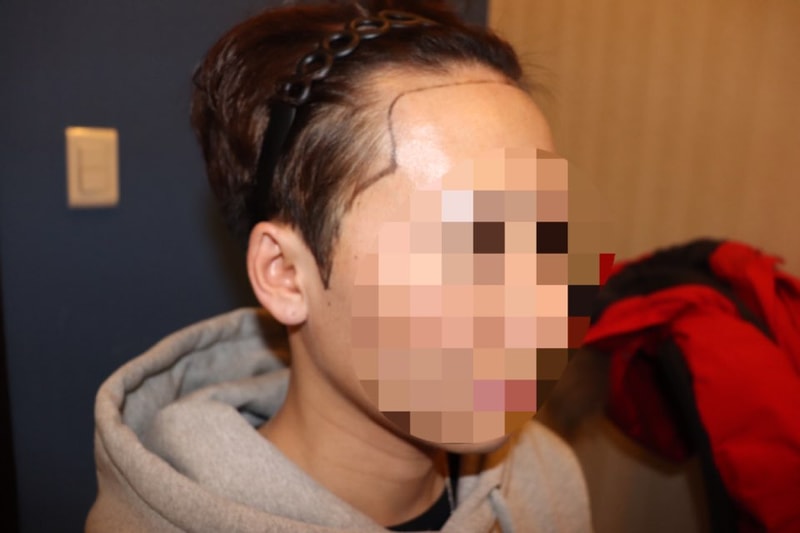 초진_측면1.jpg