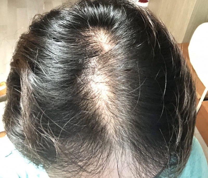 사본 -KakaoTalk_20180621_173539637.jpg