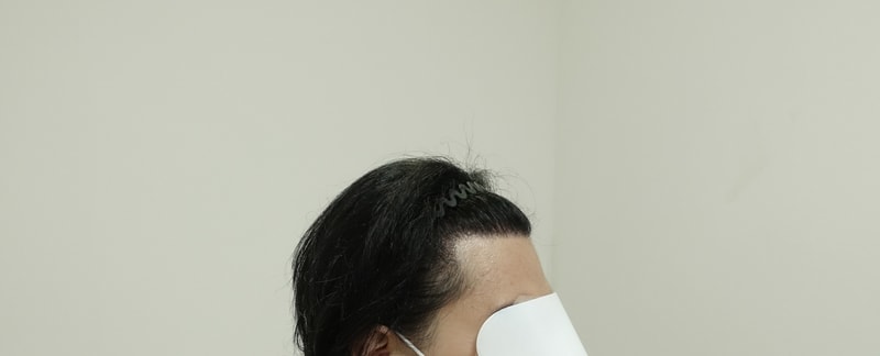 수술1년 2.jpg