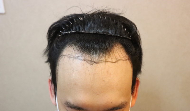 01.jpg