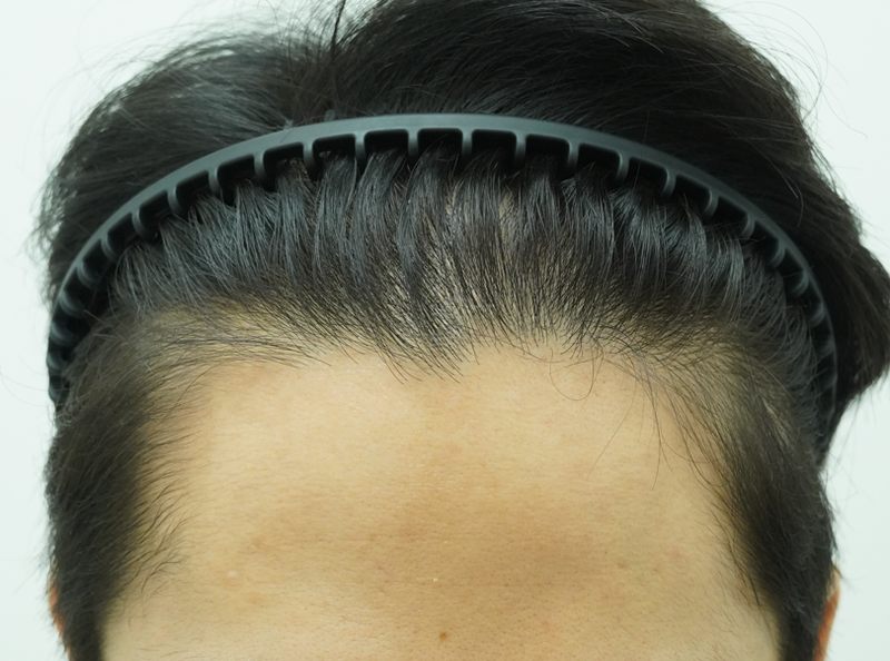 3.png
