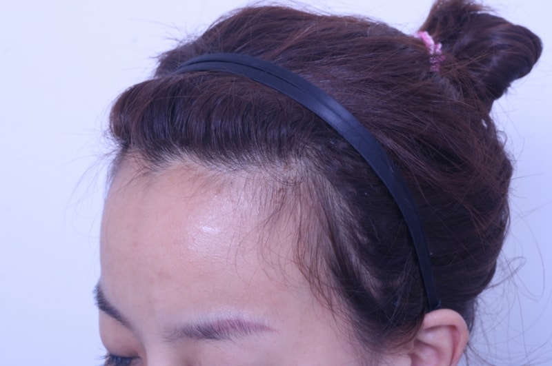 수술전 (5).JPG