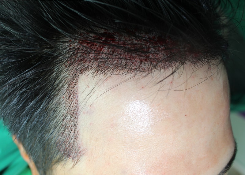 김현민-술후2.jpg