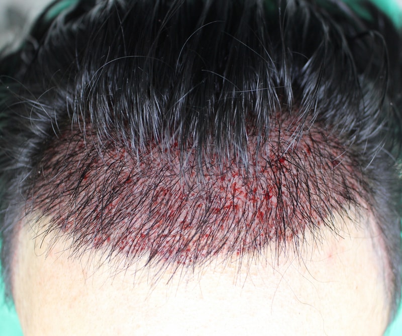 김형재술후.jpg