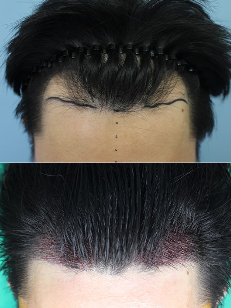 강석.jpg