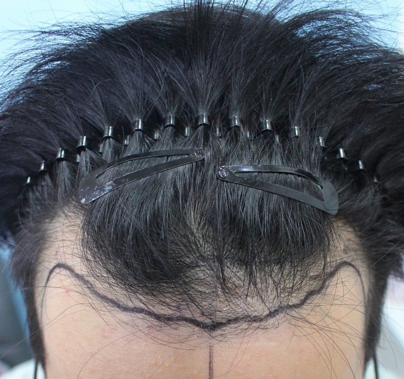 송기혁-술전.jpg