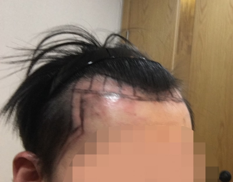 1차상담_측면.jpg