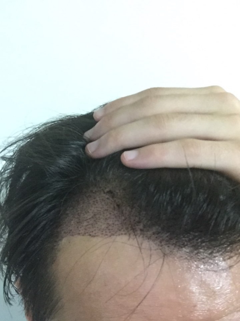 왼쪽.jpg