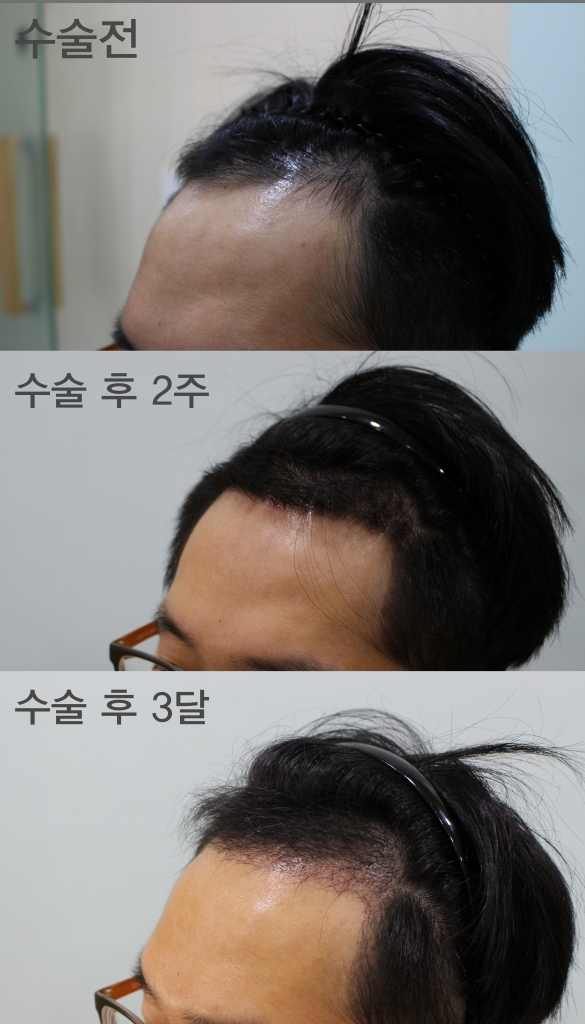 수술경과 1.jpg