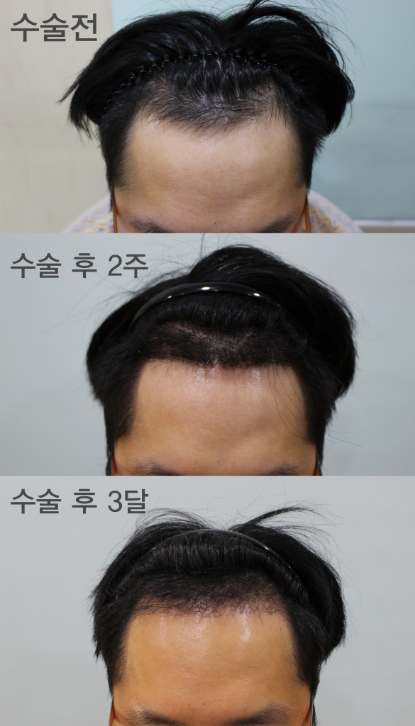 수술경과 2.jpg