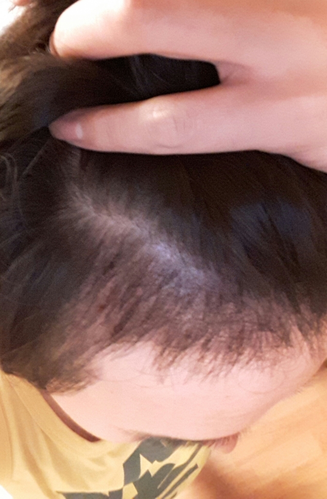 20170321_230712.jpg