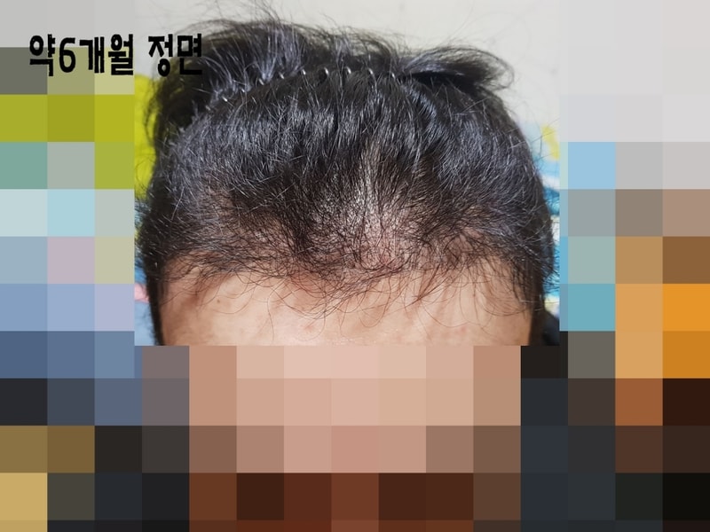 6개월 정면.jpg