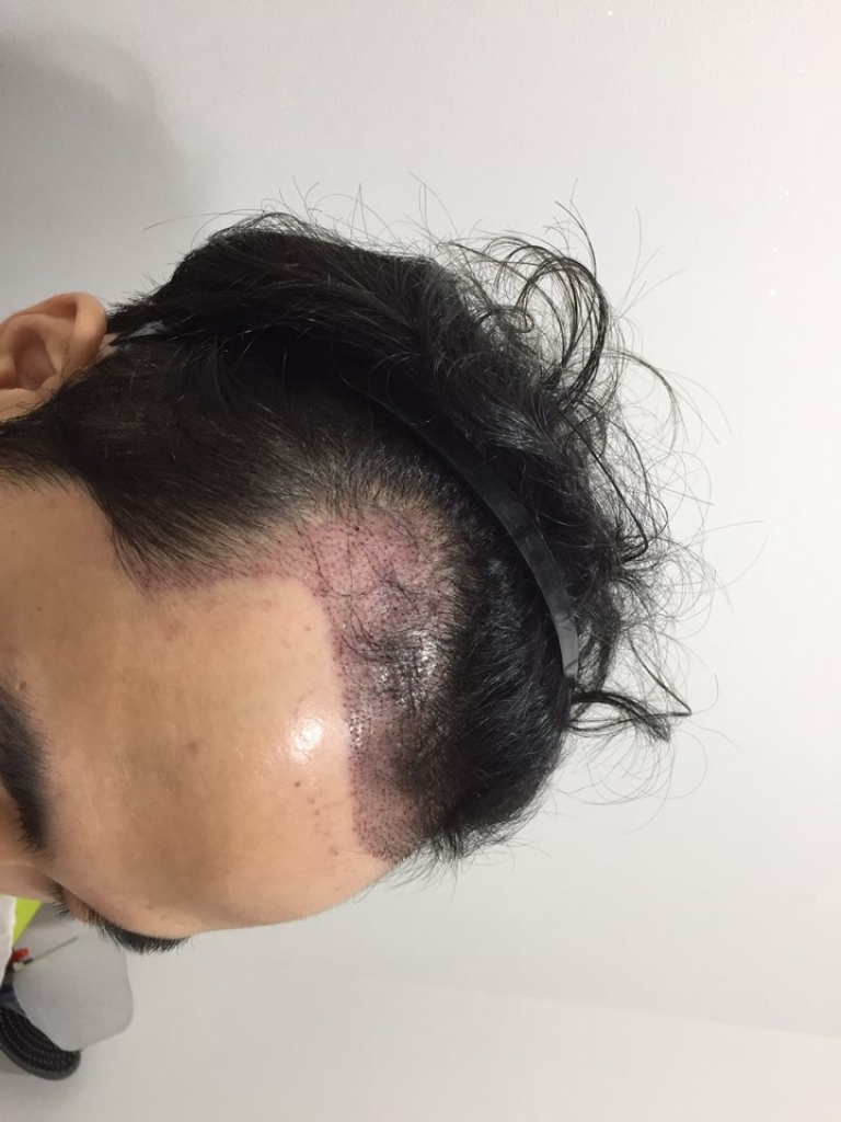 KakaoTalk_20171119_174845651.jpg