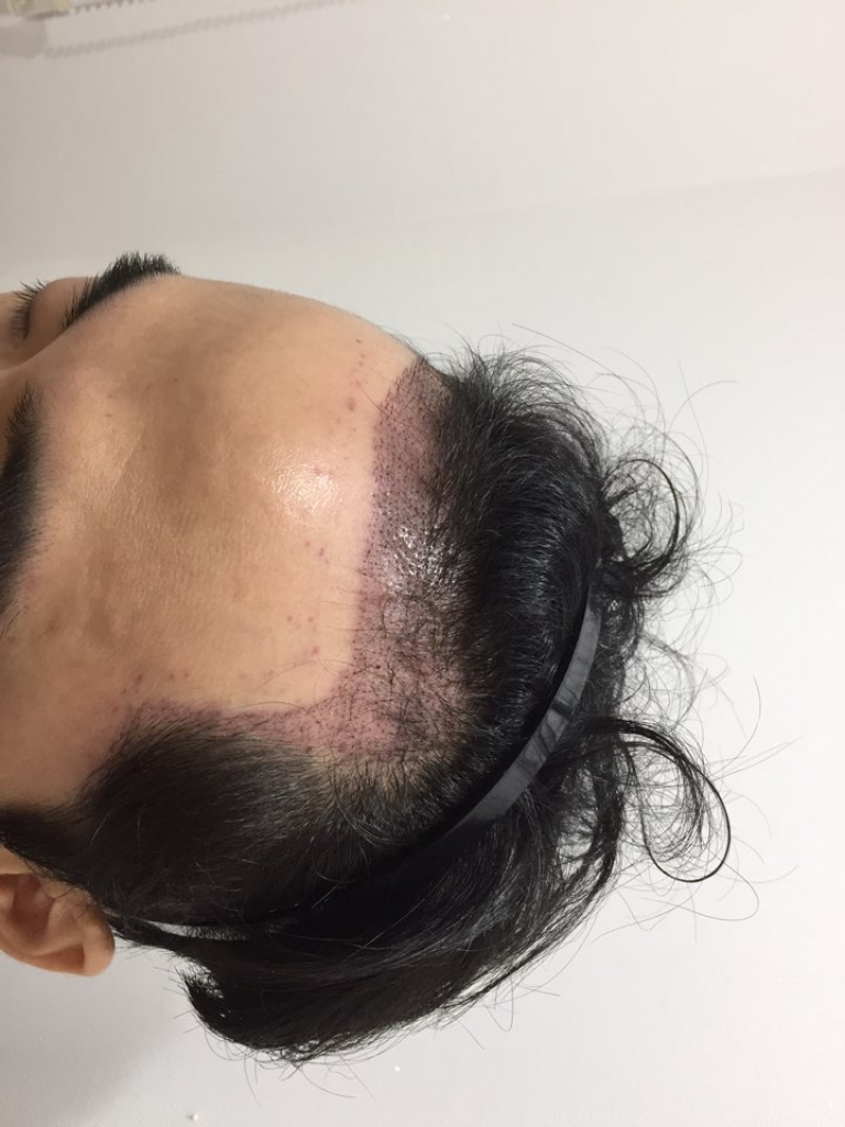KakaoTalk_20171119_174846569.jpg