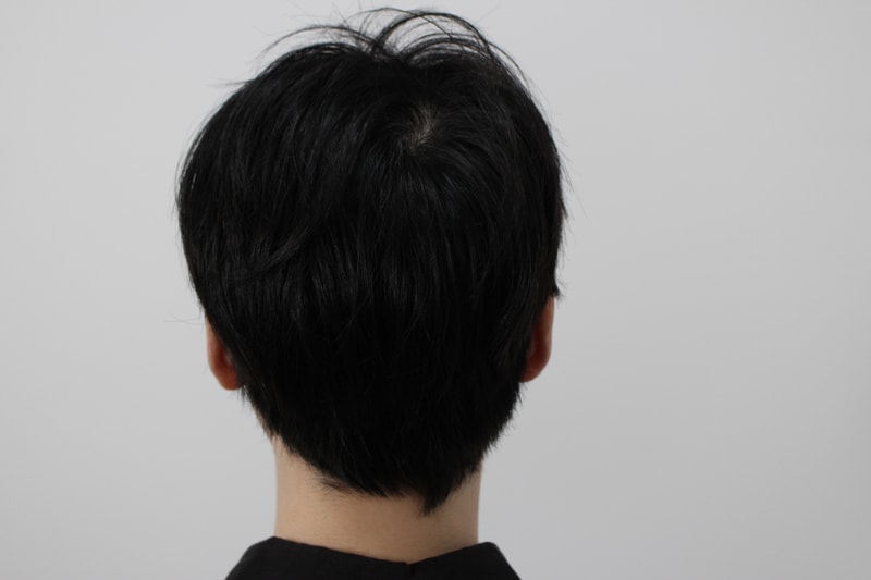 뒷머리 내린거.jpg