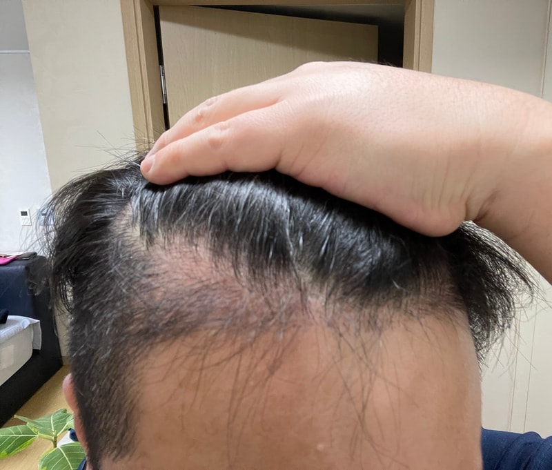 오.jpg