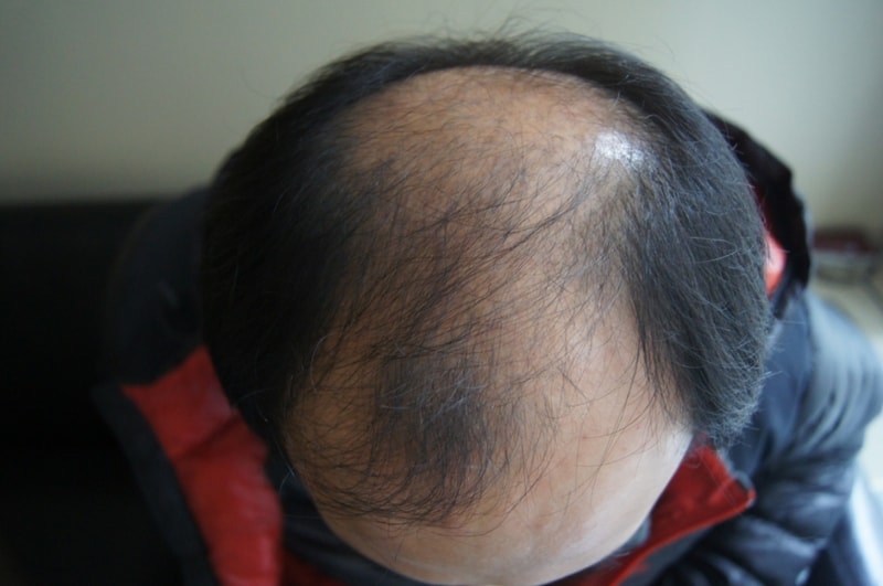 수술전1.JPG