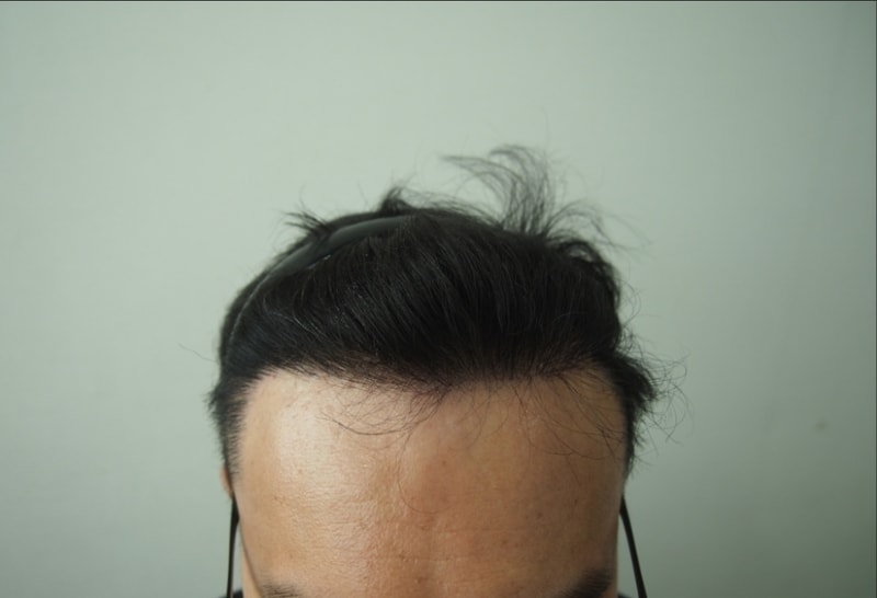 8개월차 정면.jpg
