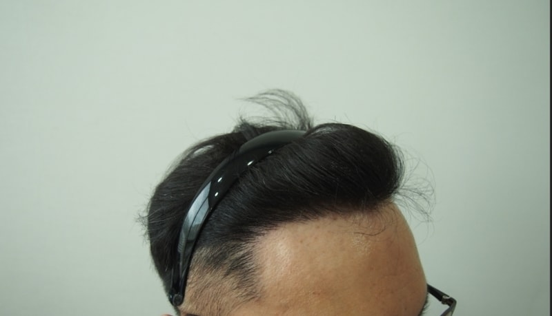 8개월차 우측.jpg