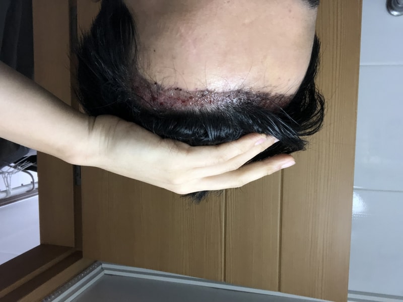 후 좌.jpeg