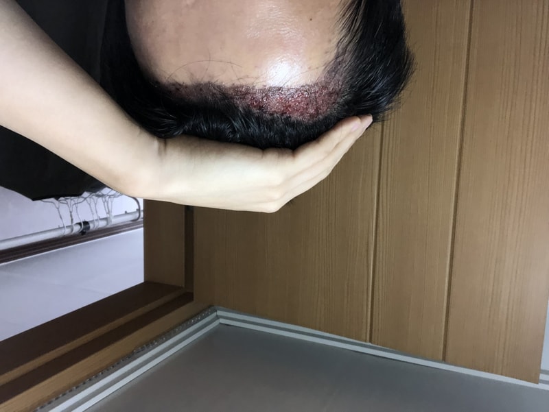 후 우.jpeg