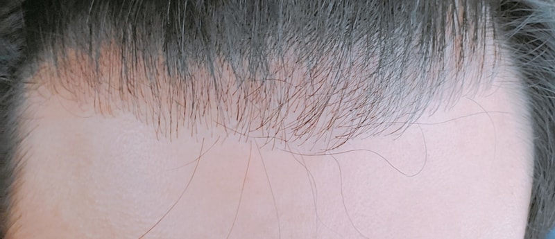 전2.jpg