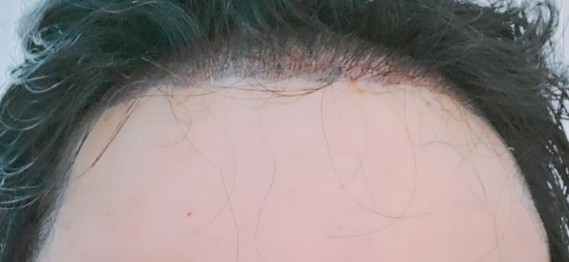 후1.jpg